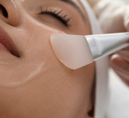 Χημικό Peeling